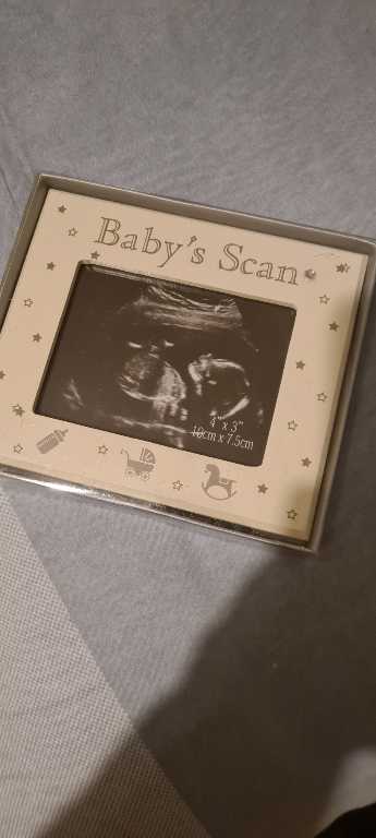 Baby Scan Photo Frame